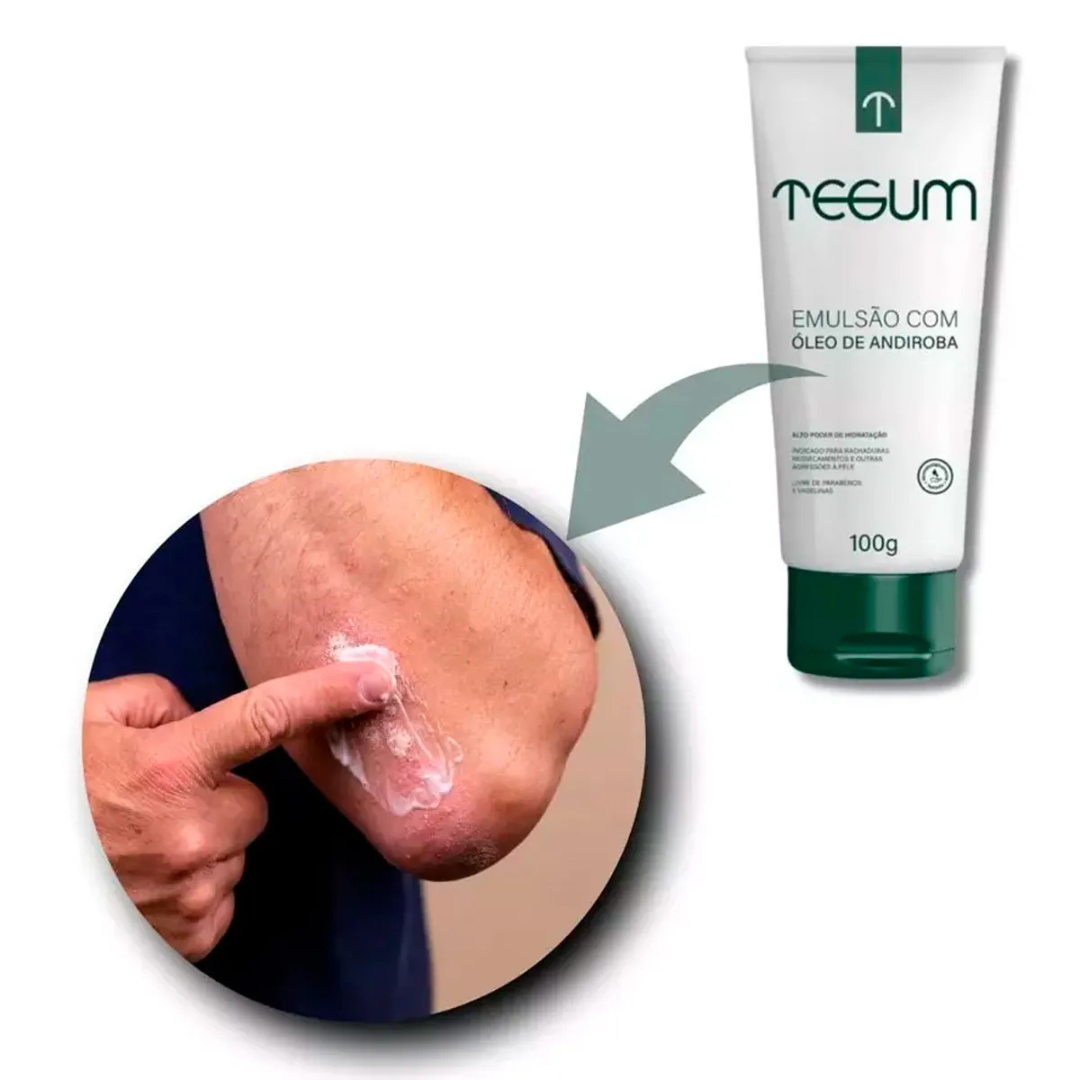 Tegum® – Creme - Caixa - Imagem 2